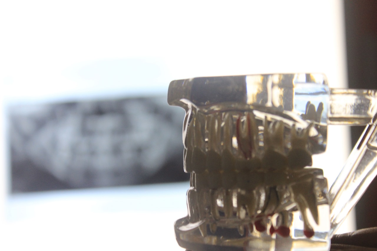 Best Dental Clinic in Uttarahalli
