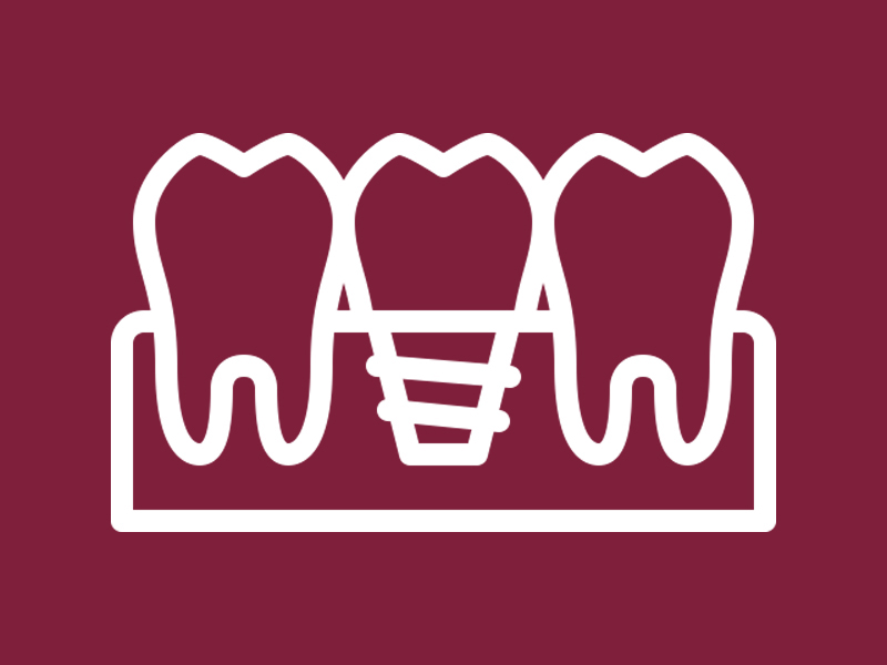 Best Dental Clinic in Uttarahalli